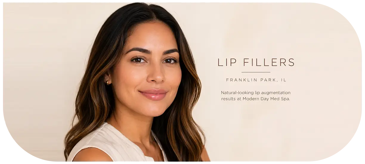 Lip Fillers Franklin Park IL — natural-looking lip augmentation results at Modern Day Med Spa