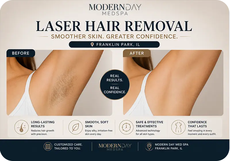 laser hair removal Franklin Park IL before after results smooth skin