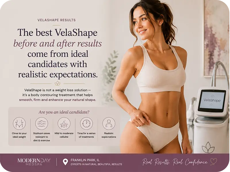 VelaShape before and after ideal candidate Modern Day Med Spa Franklin Park IL