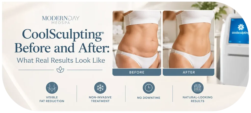CoolSculpting Before and After What Real Results Look Like