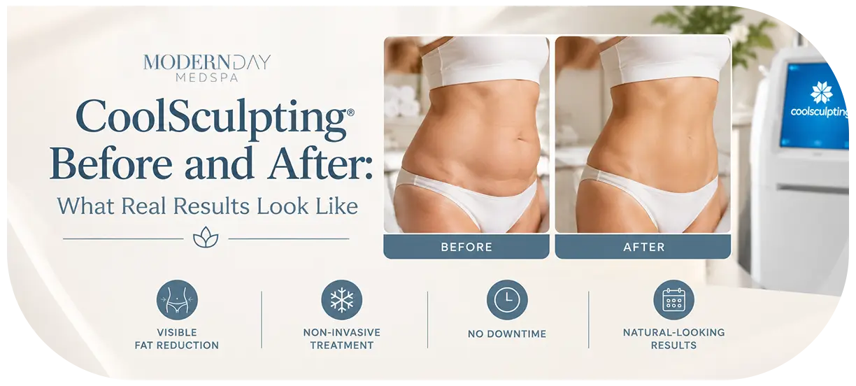 CoolSculpting Before and After What Real Results Look Like